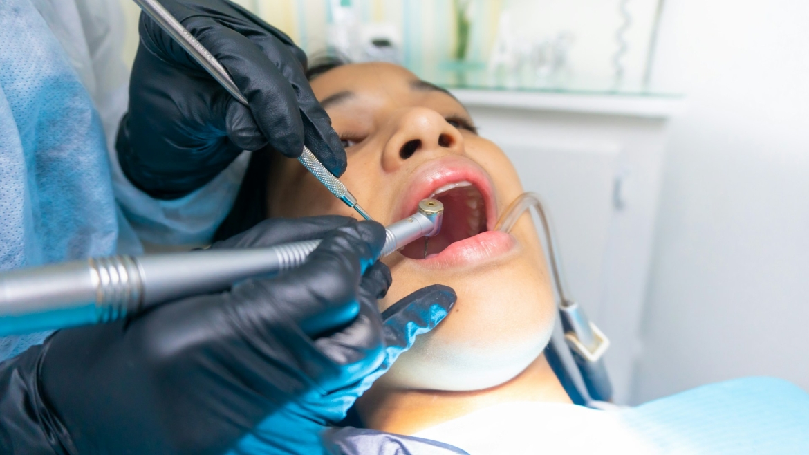 What You Need to Know About Wisdom Teeth